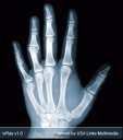 xRay