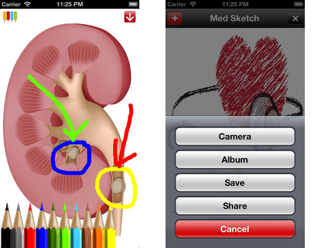 Med Sketch: Anatomy Drawing App iPhone app review | AppSafari