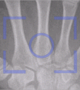 iRay Mobile X-Ray