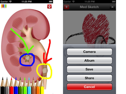 med sketch iphone app review